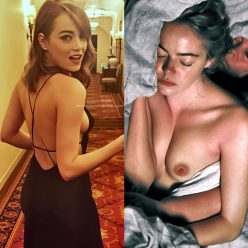 Emma Stone Nude 038 Sexy 1 Collage Photo