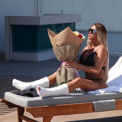 Katie Price Sits Poolside with Both Legs in Casts After Her Freak Accident in Turkey 13 Photos
