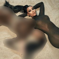 Vitiligo Brown Queen 038 Kim Kardashian Sexy 10 Photos