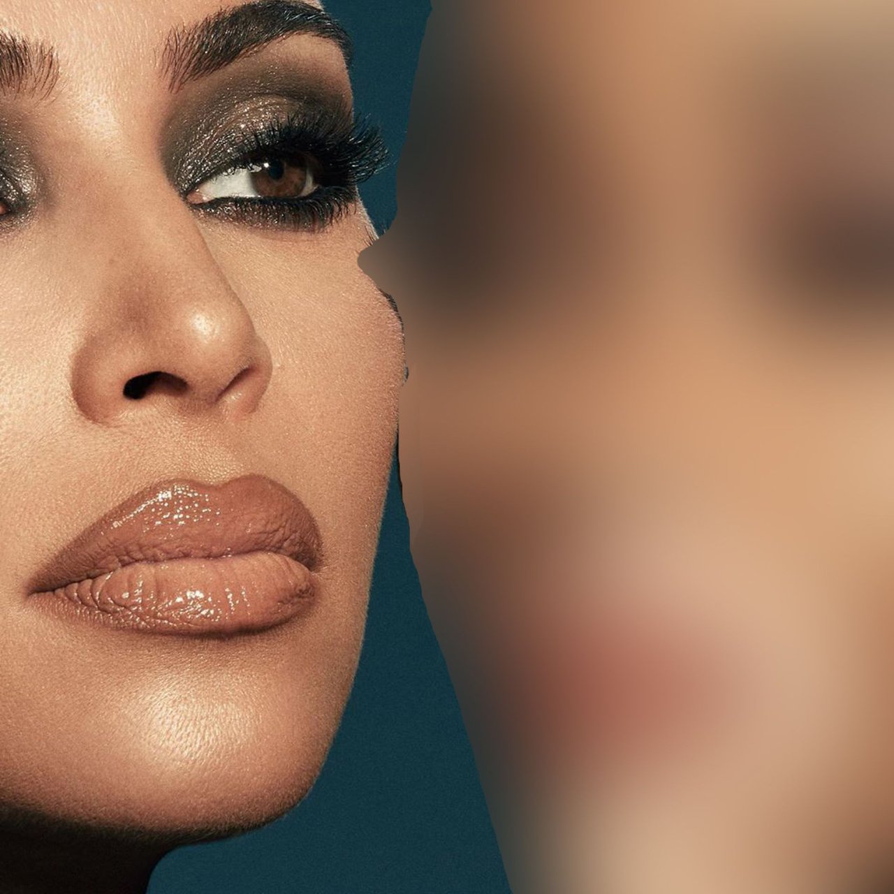Vitiligo Brown Queen & Kim Kardashian Sexy (10 Photos)